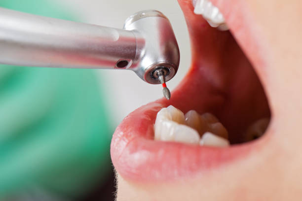 Best Emergency Dental Services for Seniors in Lewiston, UT
